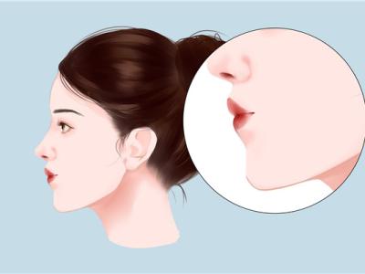 如何消除雙下巴