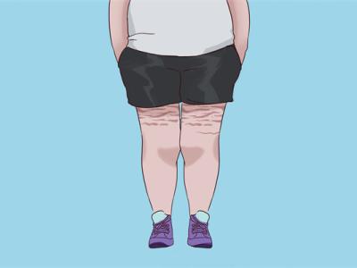 常見的減肥誤區都有哪些