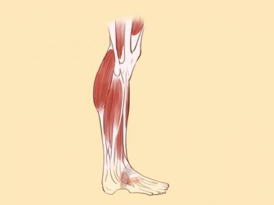 瘦小腿的方法有哪些