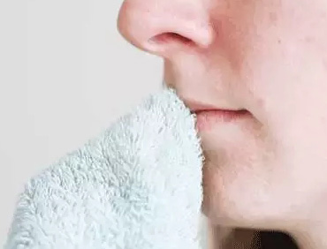  嘟嘴賣萌?麻煩先把唇部保養好再說 