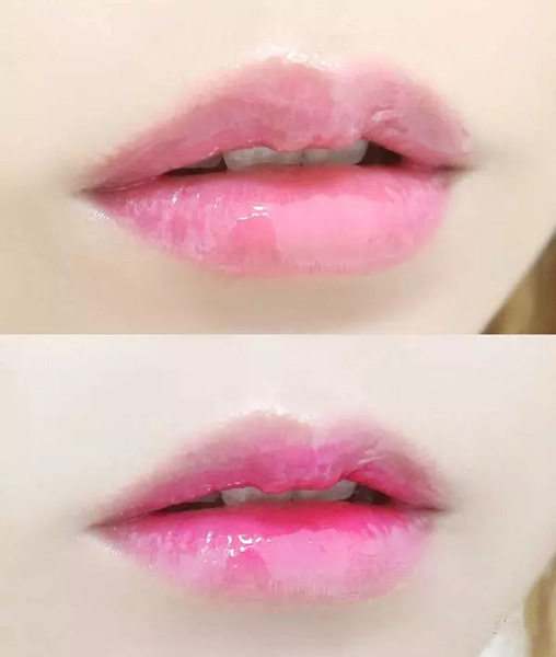  嘟嘴賣萌?麻煩先把唇部保養好再說 