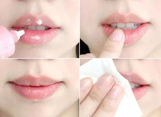  嘟嘴賣萌?麻煩先把唇部保養好再說 