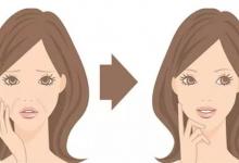 法令紋能去除嗎？去除法令紋的方法有哪些？