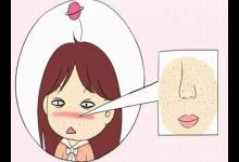 怎么才能告別“草莓鼻”變回小仙女？