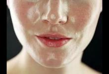 油性皮膚如何改善?皮膚科醫(yī)生有4個(gè)建議！