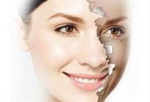 激光美白究竟能否幫你“白成一道光”？