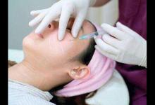 打玻尿酸要謹慎！或會留下這些后遺癥