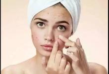 專家提醒：同時使用多種祛痘產(chǎn)品要謹慎