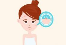 總爆痘！皮膚護理這些誤區要避免