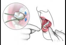 健康公開課：天天塞牙？使用牙線的“三步走”戰略送給你