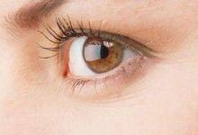 3大原因導致魚尾紋？3種醫美方式幫你去除