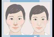 警惕!削骨手術易出現3種并發癥