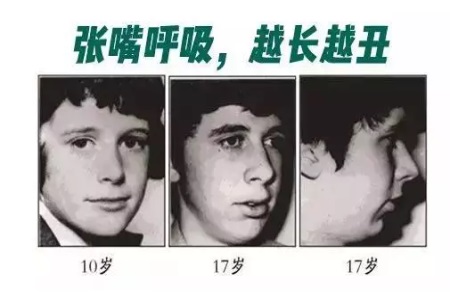 這些讓你變丑的習慣，再不改那可就沒救了！