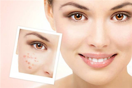 四大肌膚護理秘訣，生活護膚必備技能