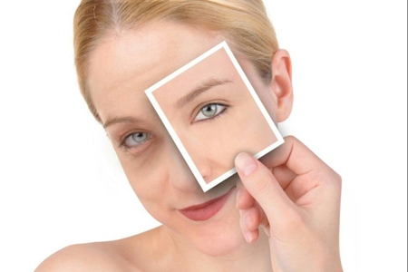 水腫、黑眼圈只是因為沒睡好？女性眼部問題潛藏的病癥