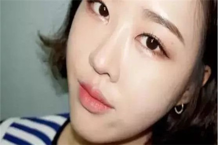 不同膚質如何正確護膚，針對肌膚問題大攻略