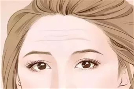 減少抬頭紋產生，你需要注意的三大步驟生活技巧