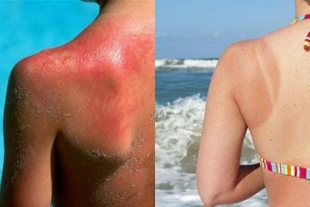 如何有效防曬,掌握兩個方法最重要-易網(wǎng)健康<a href=http://www.gyfww.com/jkys/ target=_blank class=infotextkey>養(yǎng)生</a>網(wǎng) 如何有效防曬,掌握兩個方法最重要