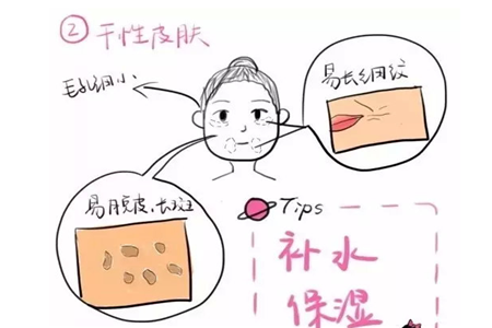 你是干性還是油性肌膚，膚質不同護膚措施也不同