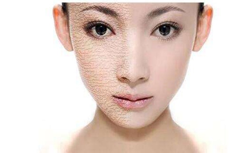 皮膚粗糙過敏易出油，好習慣讓女性養出美麗肌膚