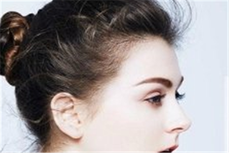 魚尾紋形成的原因是什么?怎樣才能有效去除