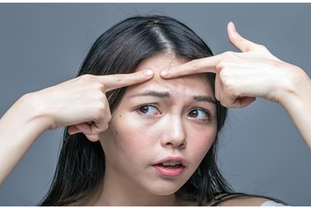 女生額頭長痘的原因，對癥下藥才能有干凈肌膚
