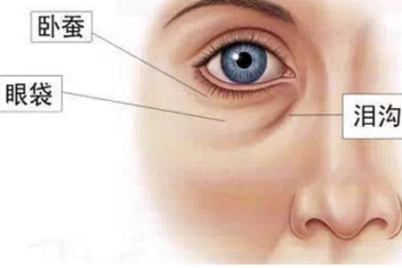 女性眼袋深是怎么形成的，消除眼袋的方法喚醒精神