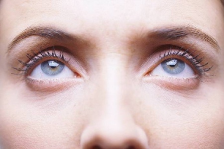 女性眼袋深是怎么形成的，消除眼袋的方法喚醒精神