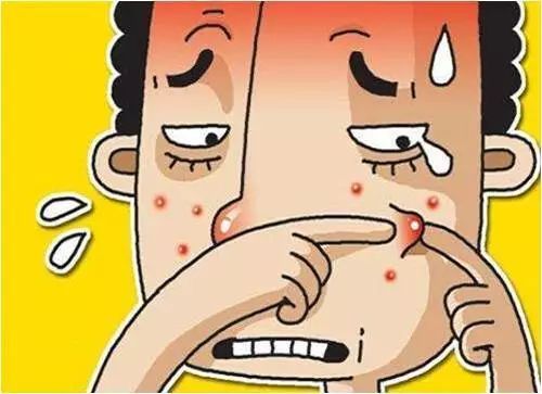 痤瘡不斷  收好這份戰(zhàn)“痘”書