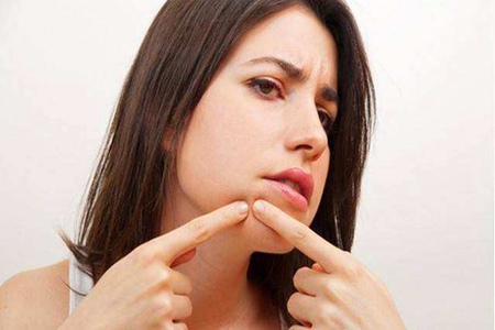 痘痘長在嘴角周圍是怎么一回事，女性清痘只需三招