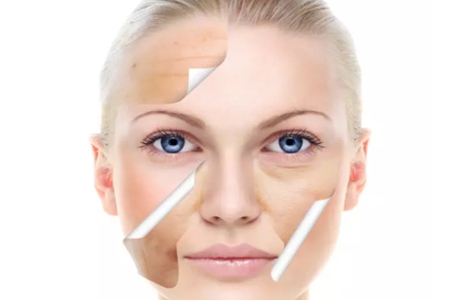 膠原蛋白五個功效和作用，女性保持年輕都靠它