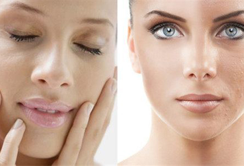 對抗毛孔粗大問題 需從這3點入手！