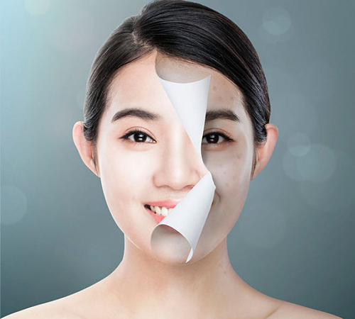 女人祛斑養顏的方法有哪些?4個方法讓肌膚凈白無暇-易網健康養生網 女人祛斑養顏的方法有哪些?4個方法讓肌膚凈白無暇