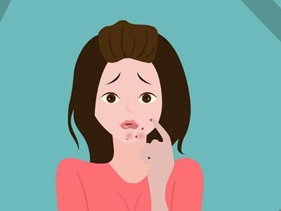 女性下巴長痘，原來是身體這里出問題，教你五招去除痘痘