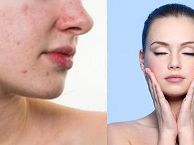 閉口是什么，它會(huì)慢慢自己消失嗎，去除閉口要靠這四招