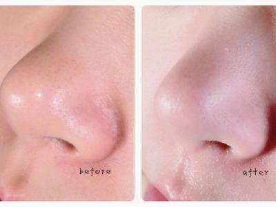 面膜起泡泡怎么回事?其原理是什么?