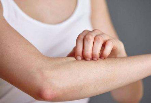 為什么皮膚會出現過敏性瘙癢?幫你揪出4個元兇-易網健康<a href=http://www.gyfww.com/jkys/ target=_blank class=infotextkey>養生</a>網 為什么皮膚會出現過敏性瘙癢?幫你揪出4個元兇