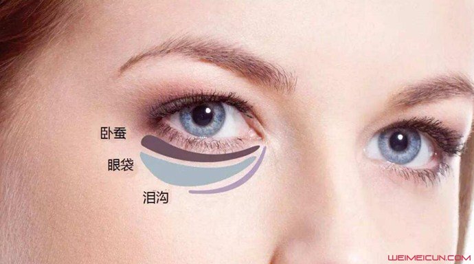 怎樣去除眼袋最有效的方法是什么 幾個實用小妙招推薦