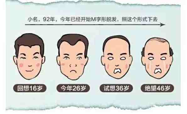 沒有家族脫發史 我為什么年紀輕輕也禿了