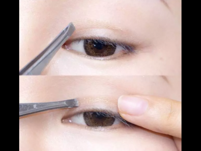 雙眼皮貼久了會變成雙眼皮嗎？為什么有人貼成了雙眼皮？