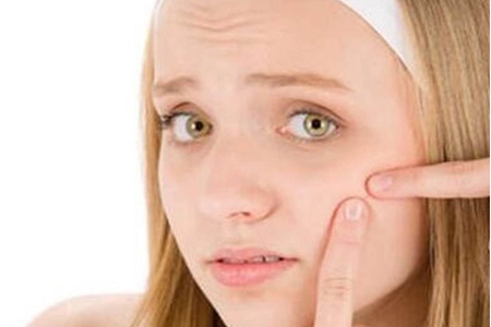 女生30歲臉上長痘痘的原因，長痘痘效果最佳的治療方法