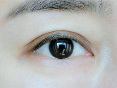 雙眼皮貼什么牌子好?什么牌子的雙眼皮貼最隱形?