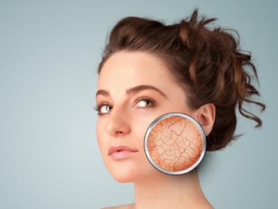 臉上紅血絲怎么引起的 改善紅血絲的方法有哪些？