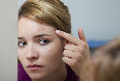 額頭長(zhǎng)痘的原因及調(diào)理方法 杜絕痘痘橫行