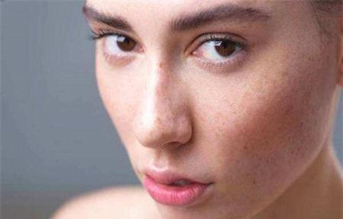 干性皮膚為什么容易長斑？色斑和皮膚干的聯系