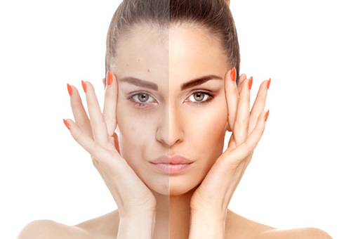 額頭長(zhǎng)痘的原因及調(diào)理方法 杜絕痘痘橫行