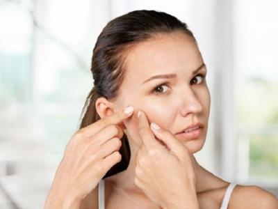 為什么不能用手擠痘痘？用手擠痘痘的危害