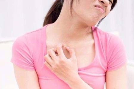 濕疹怎么治好得快？輕微濕疹和重度濕疹治療方式要區別對待