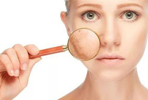 春季容易皮膚瘙癢 原來是這4個原因造成的！