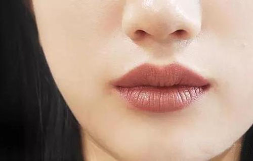 嘴唇邊緣顏色深如何淡化？淡化唇色的方法